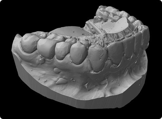 Artec Micro Dental