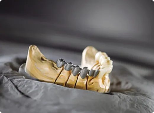 Concept laser mlabs dental image