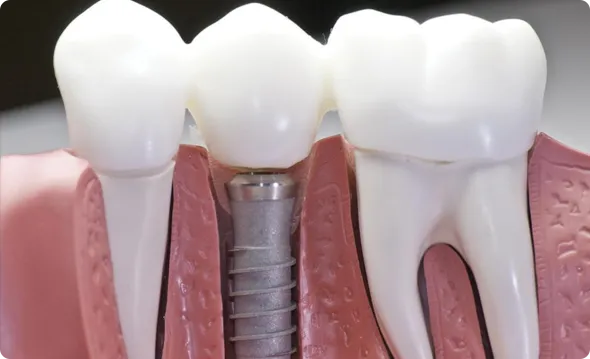 Dental resource image