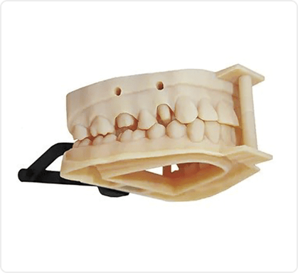 Dental Prosthesis